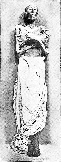 Mummified remains of Ramses II. Photo by anonymous (date unknown). Cairo Egyptian Museum. PD-70+. Wikimedia Commons.