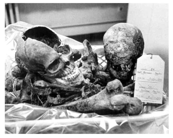 Skeletal remains of Martin Bormann. Photo by anonymous (c. 1998).