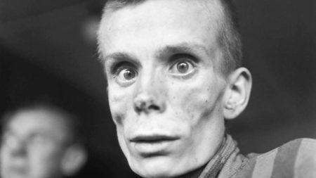 An 18-year-old Russian Jew suffering from dysentery in KZ Dachau. The concentration camp was liberated by the Americans on 29 April 1945. Days later, this photograph was taken. 